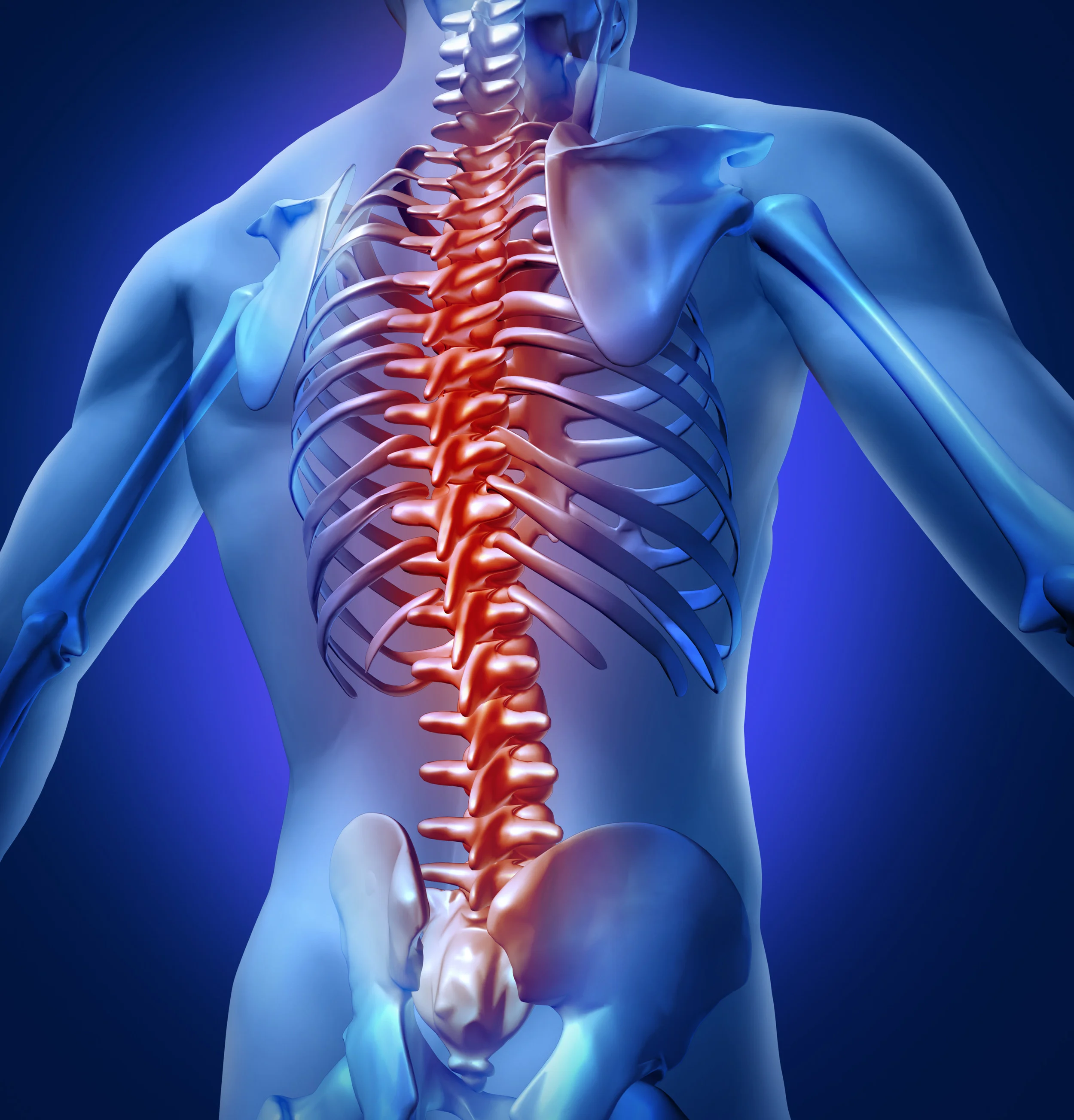 spine xray.jpg