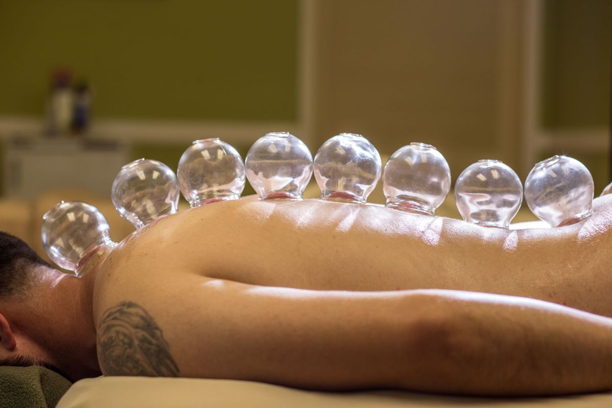 cupping.jpg