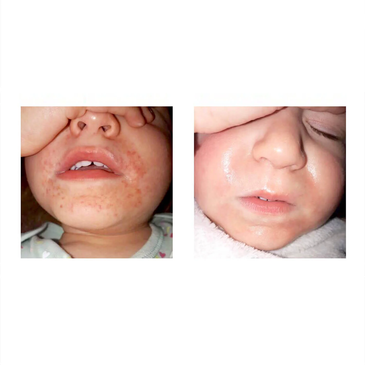 Before-After-1.jpg