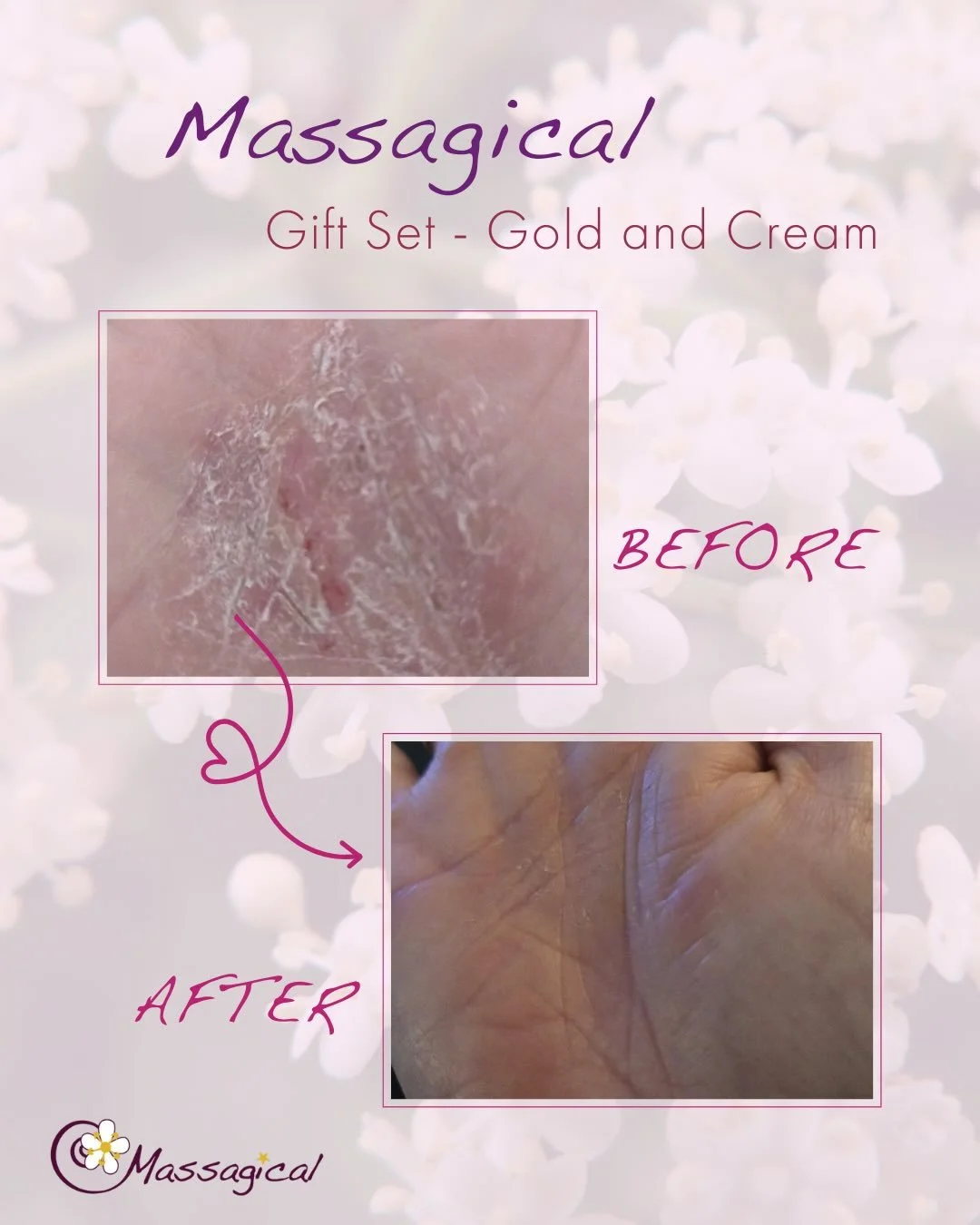 Who doesn&rsquo;t love a before and after?! 🩷

A lovely customer at a recent show had been struggling with very dry cracked skin on her hands for years, and was in need of some proper nourishment. 🤲🏼

Enter Massagical&hellip; natural ingredients, 