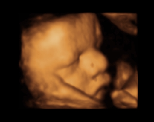 Imaging Miracles Springfield Mo Blog Laughing Arrow Photography