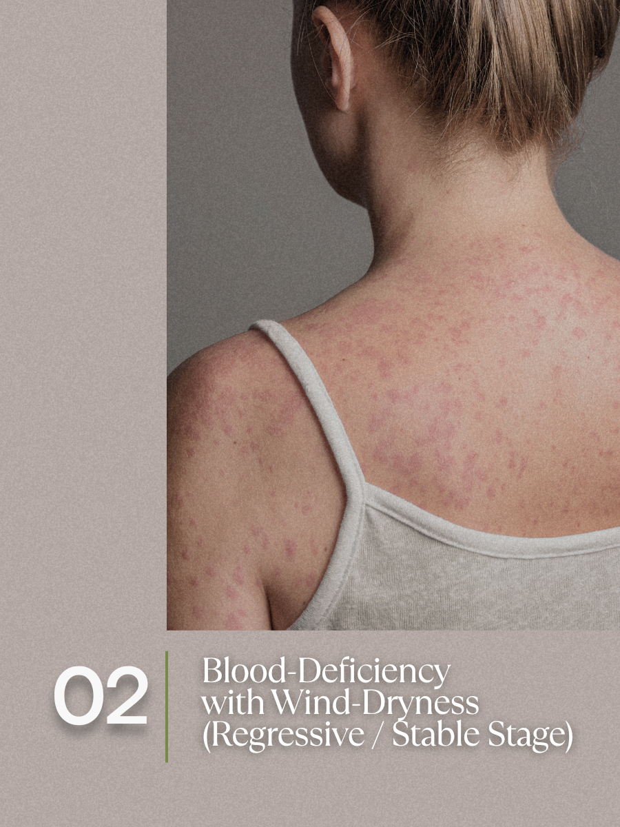 Blood-Deficiency with Wind-Dryness — Regressive or Stable Stage  H3