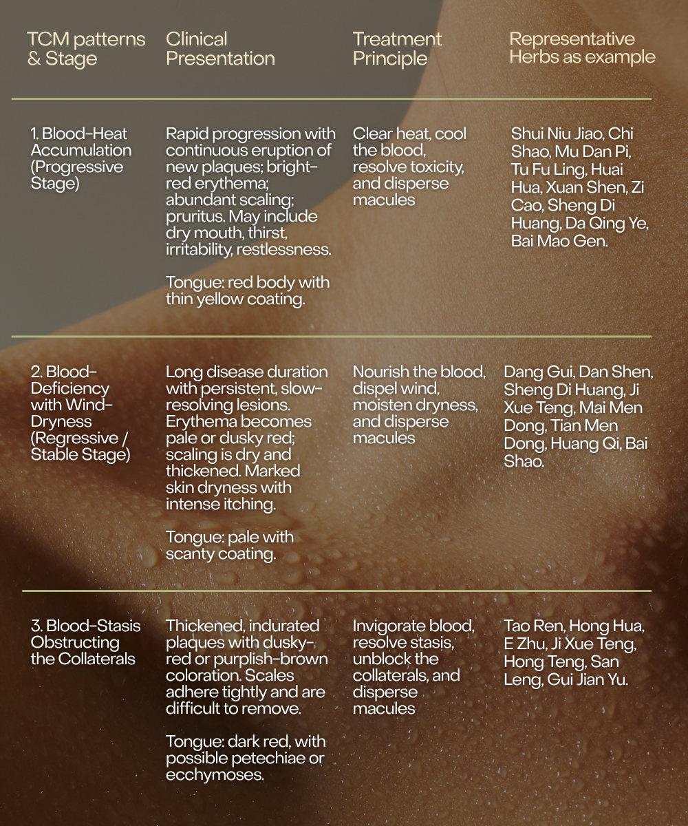 How Psoriasis Patterns Can Change Over Time