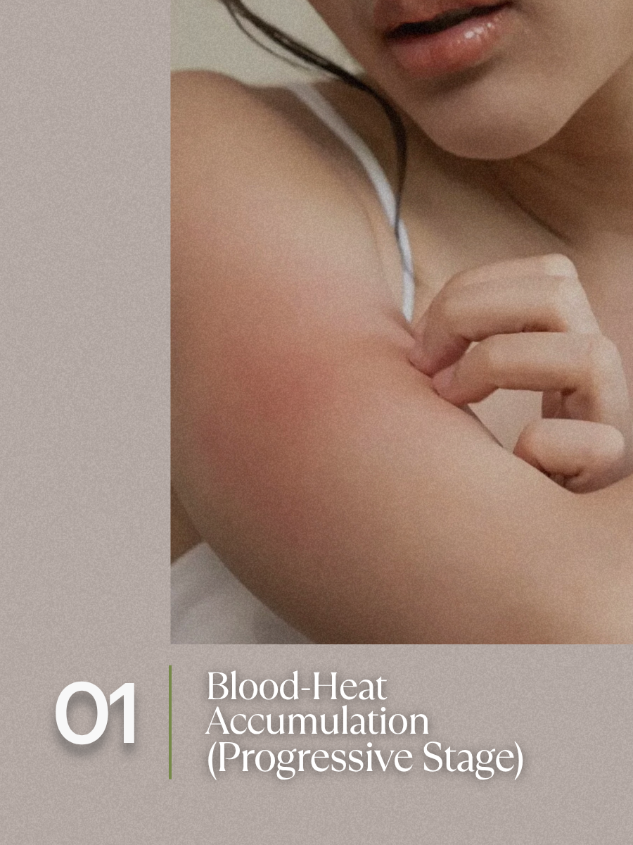 Blood-Heat Accumulation — Progressive Stage