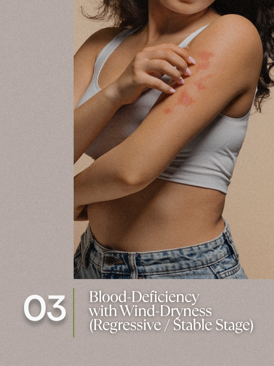 Blood-Stasis Obstructing the Collaterals — Stable Stage