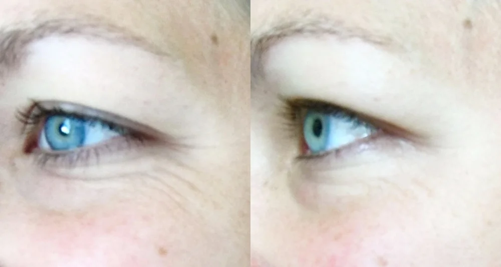 Somewhere between 4 and 6 weeks in between, and I did my best to use same lighting/positioning/time of day. I was rocking a small smile in each photo.