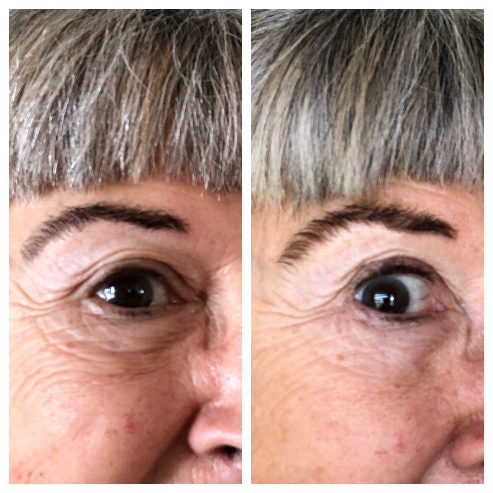 Before and after a seven day trial of PRAI Ageless Eye Tight Uplift Serum and Ageless Eye D-Crease.