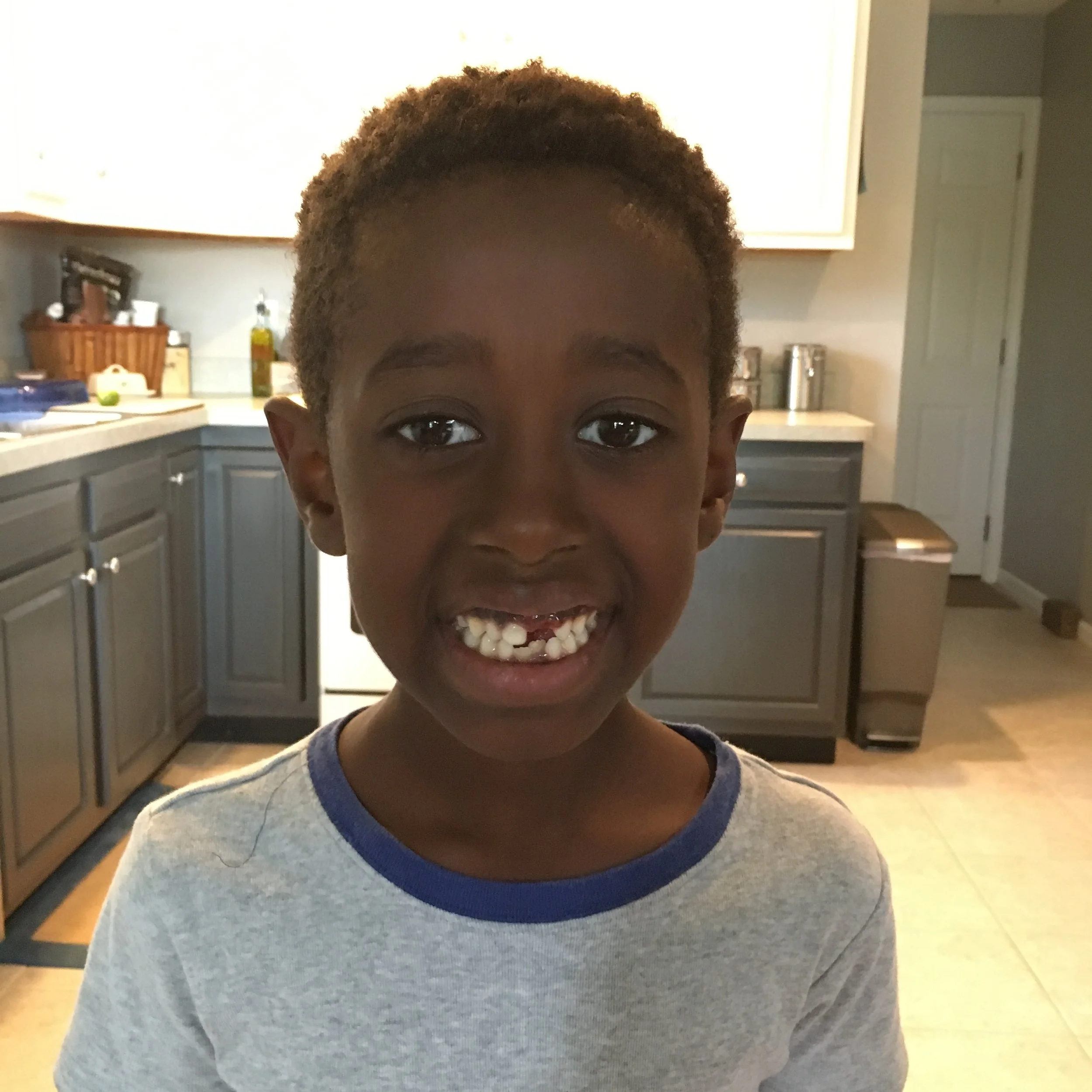 Another tooth bites the dust! 