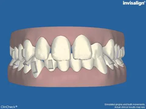 Case Study 1: Stage 1