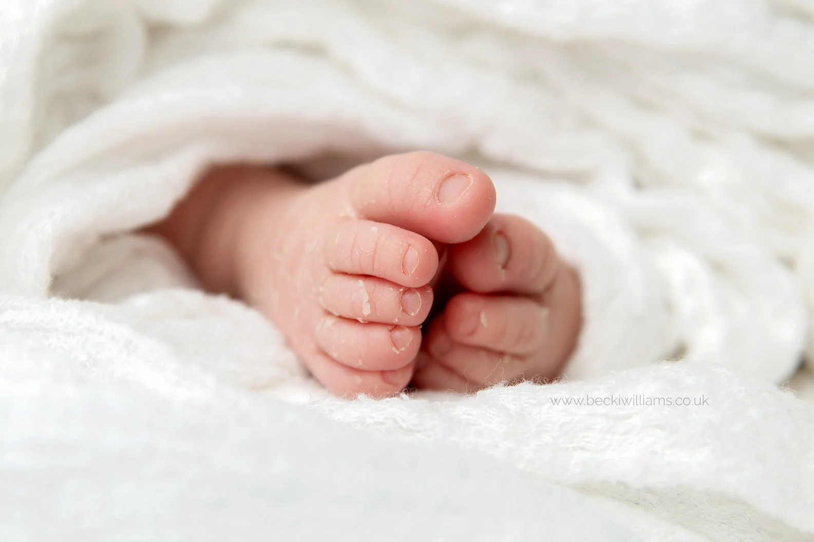 close up of newborn baby toes with dry skin