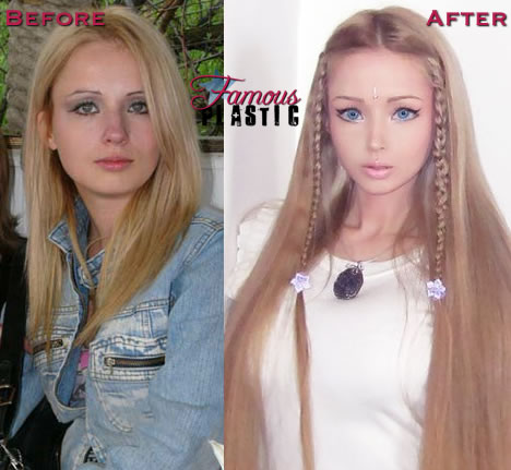 rygte Outlook Forældet Woman turns herself into real-life Barbie doll. | Sex Therapy, Counselling,  Psychology Services Vancouver