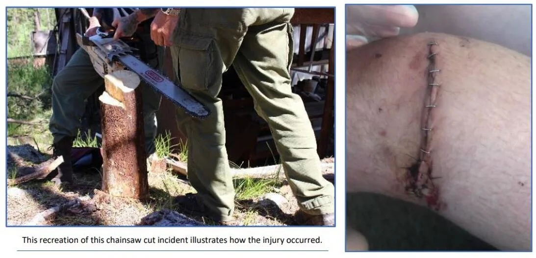 Chainsaw Accident.jpg