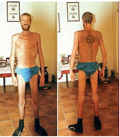 Ricky Megee lost over half his body weight while stranded in the Australian outback for 70 days.