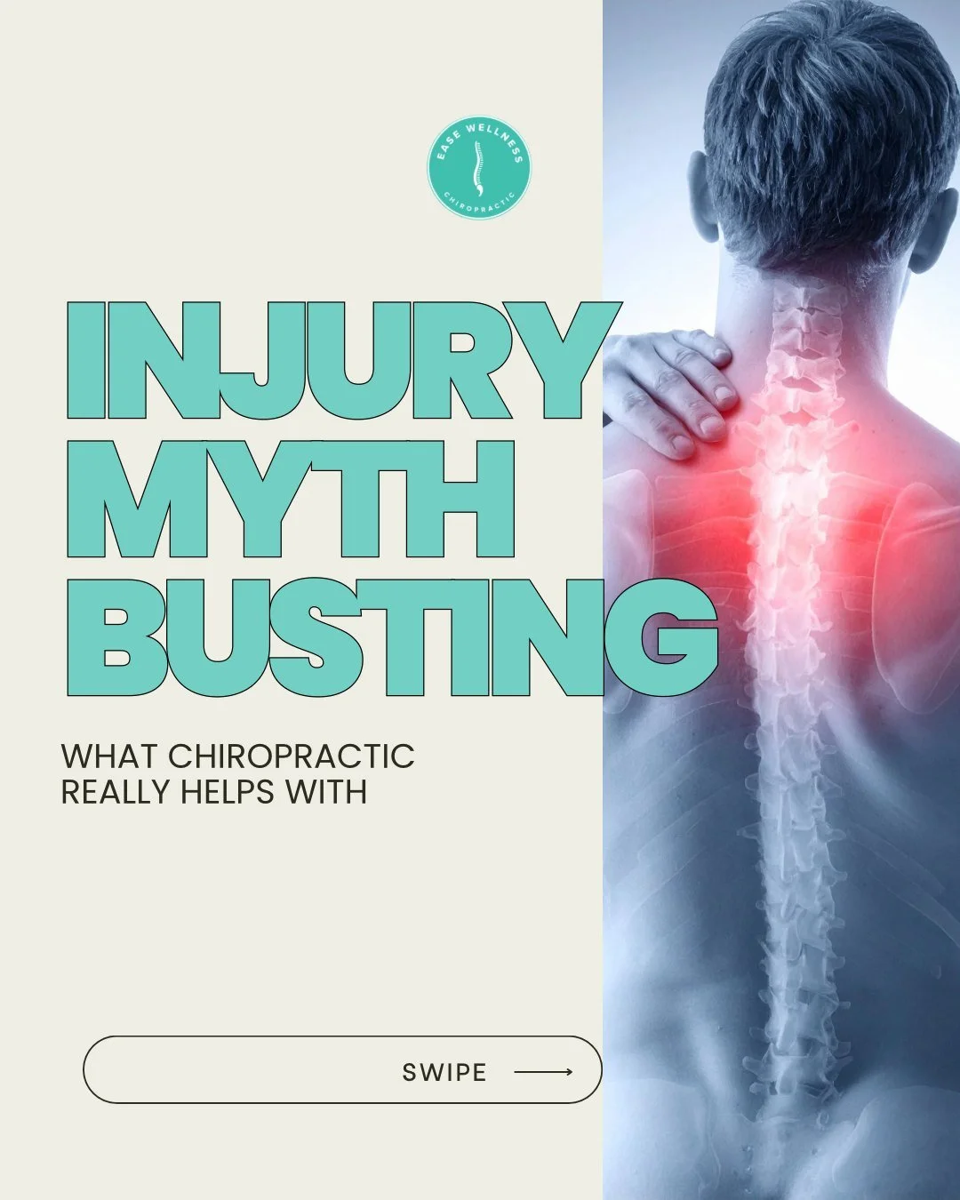 ❌ Myth : Chiropractic is only for back pain.
✅ Fact : Chiropractic care benefits multiple systems

&bull; Headaches &amp; migraines
&bull; Neck pain &amp; whiplash
&bull; Post-injury recovery
&bull; Joint and nerve function

Explaining how insights l