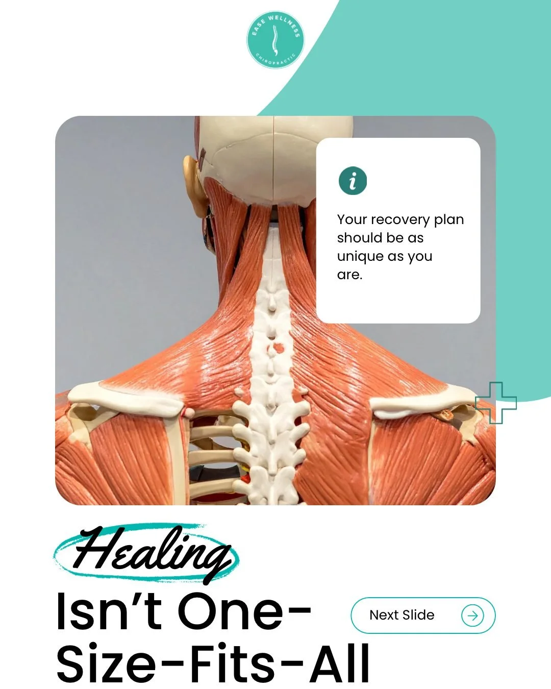 💡 Your recovery plan should be as unique as you are.

At Ease Wellness, every personal injury patient gets a customized care plan &mdash; including spinal and extremity adjustments, soft tissue therapy, and rehab techniques tailored to your goals. H