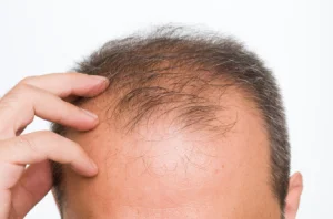 hair.jpg