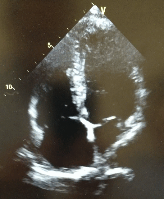 Dr Martin GP echocardiogram.gif