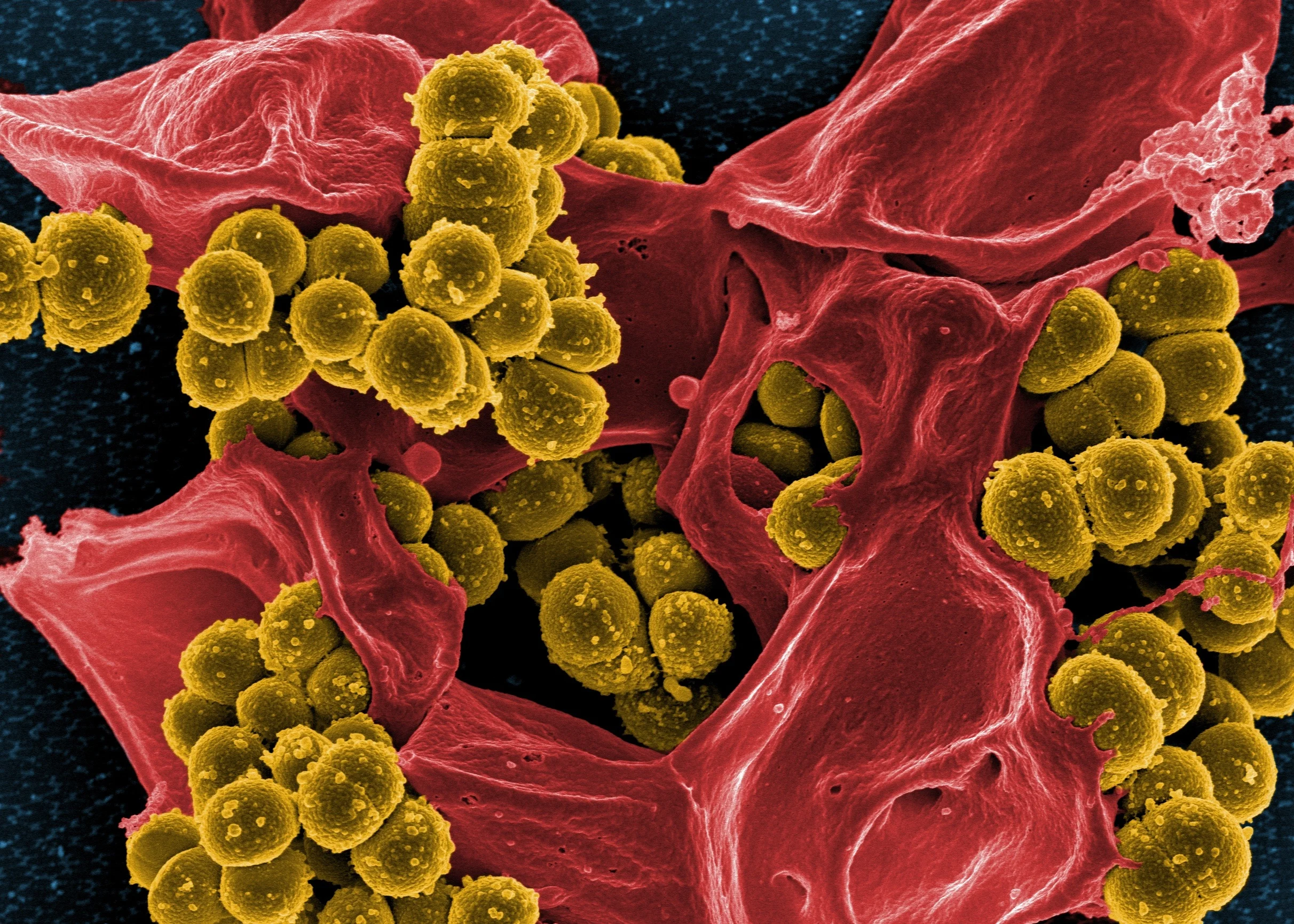 bacteria-808158.jpg