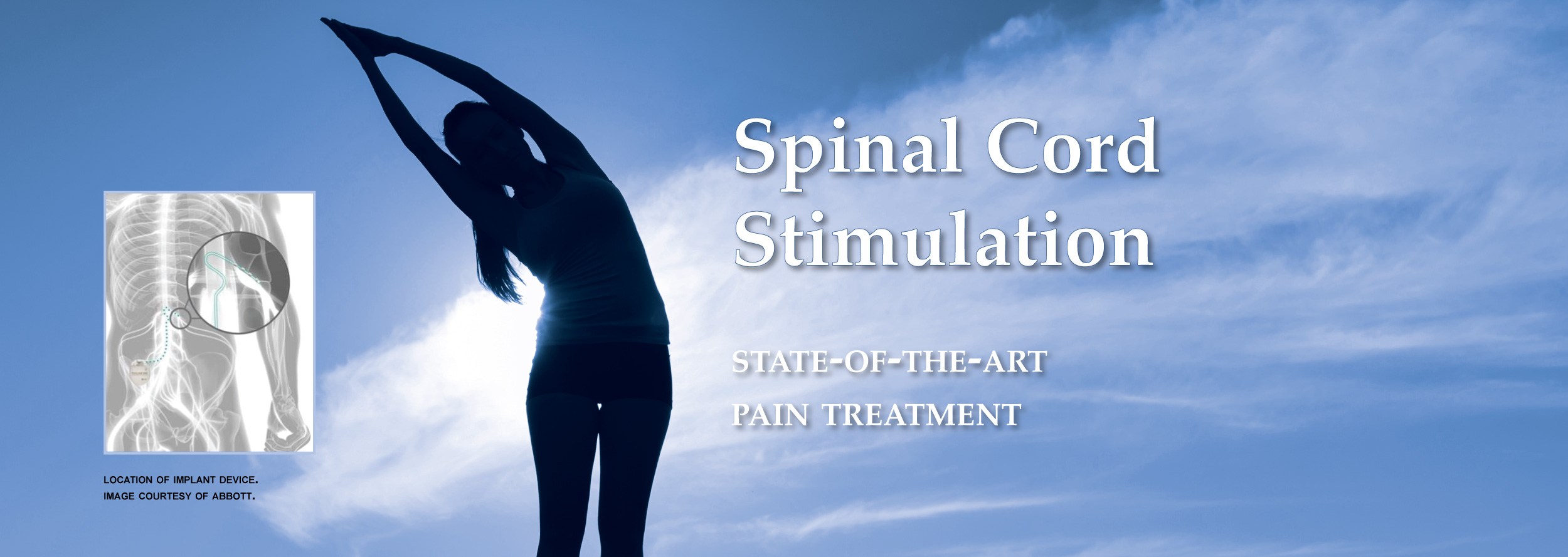 spinal-cord-stimulation-banner2.jpg