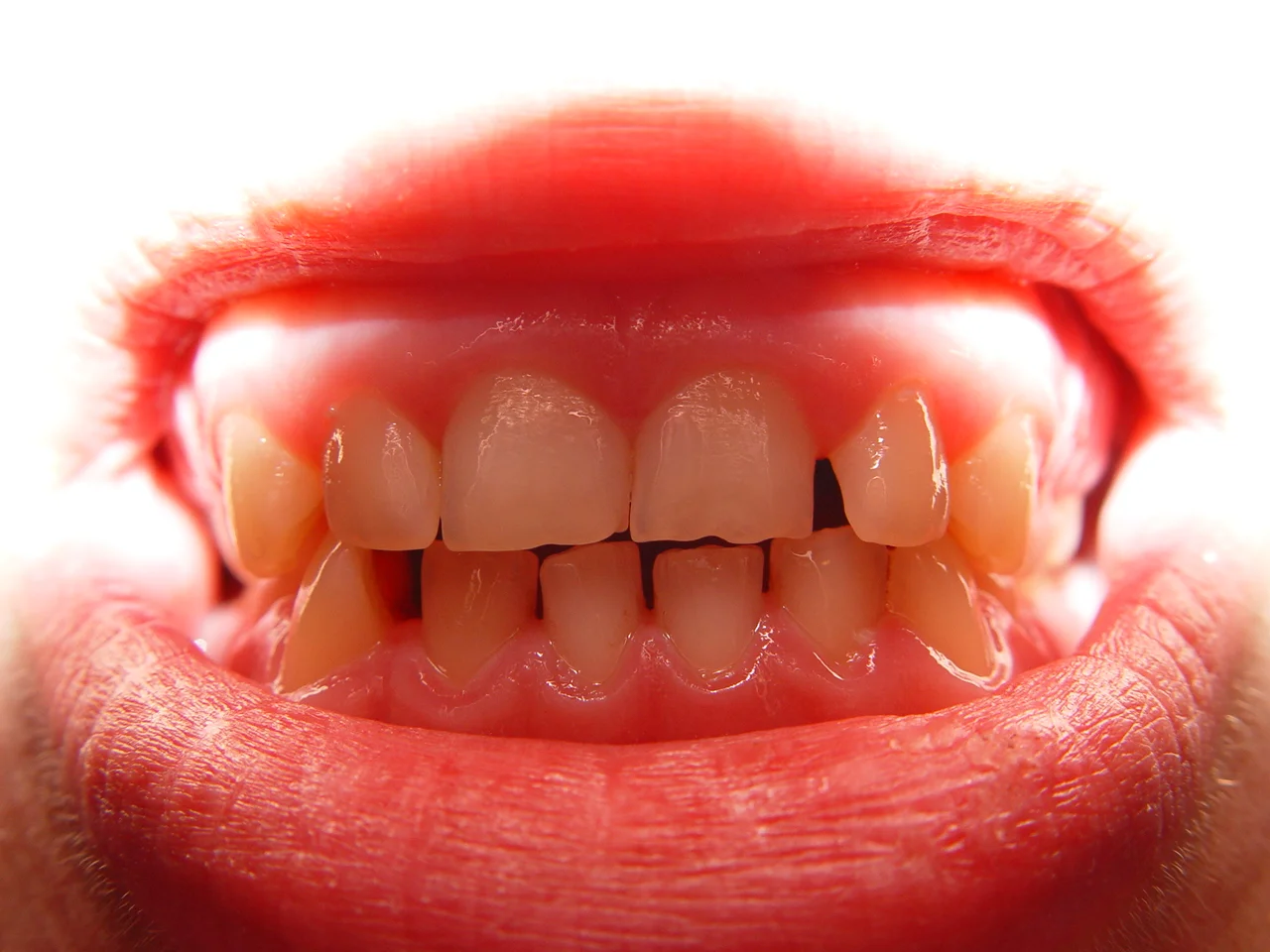 josiahs-teeth_10214433525_o.jpg
