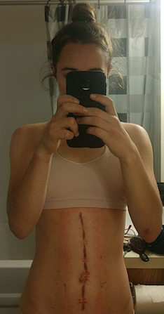 An almost healed belly! And another selfie!