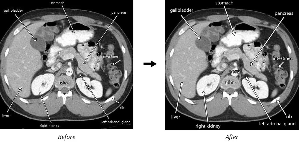 Table/image reformatting — Medical Journal Editors (MJE)