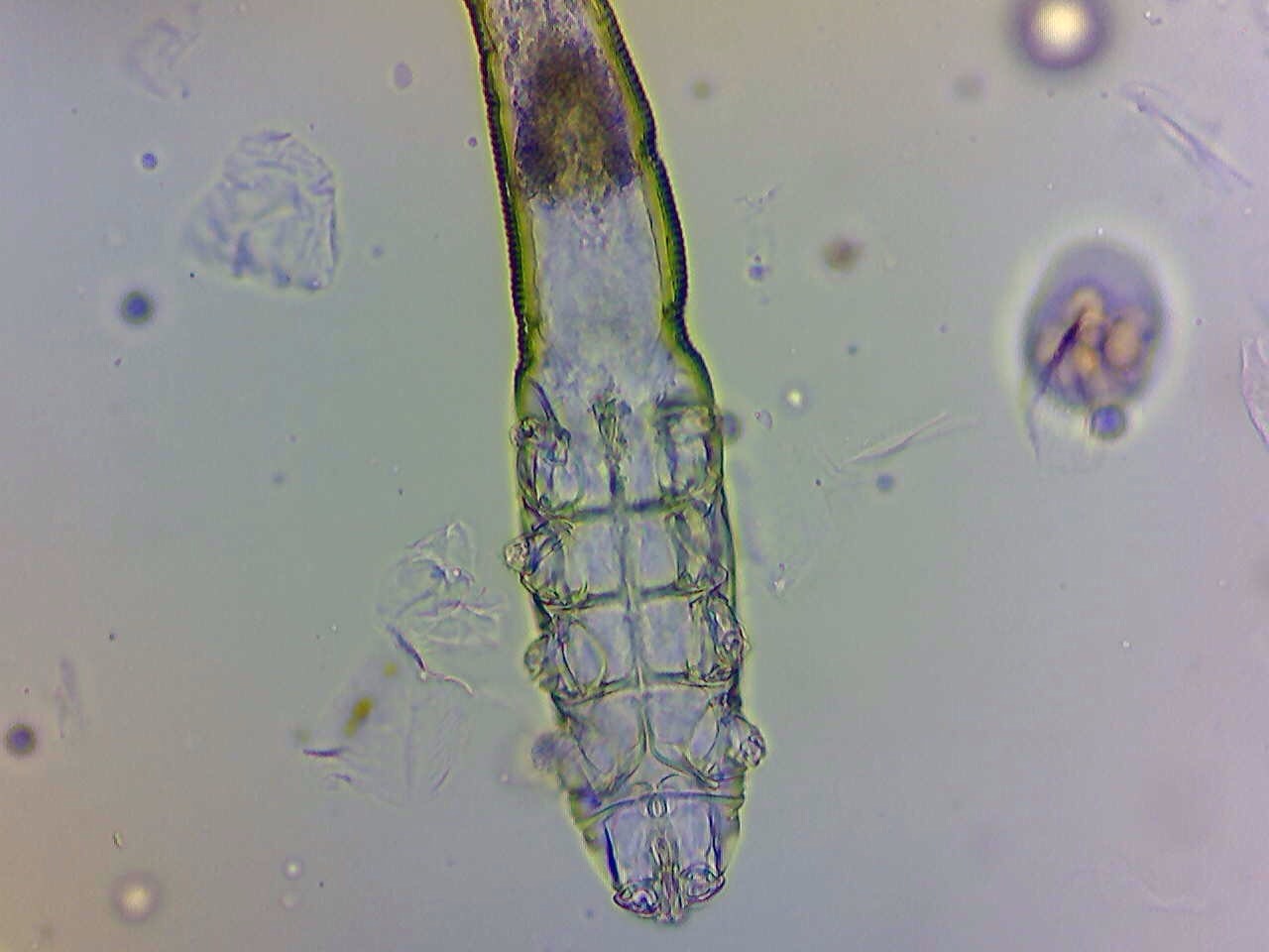 A demodex mite seen under the microscope