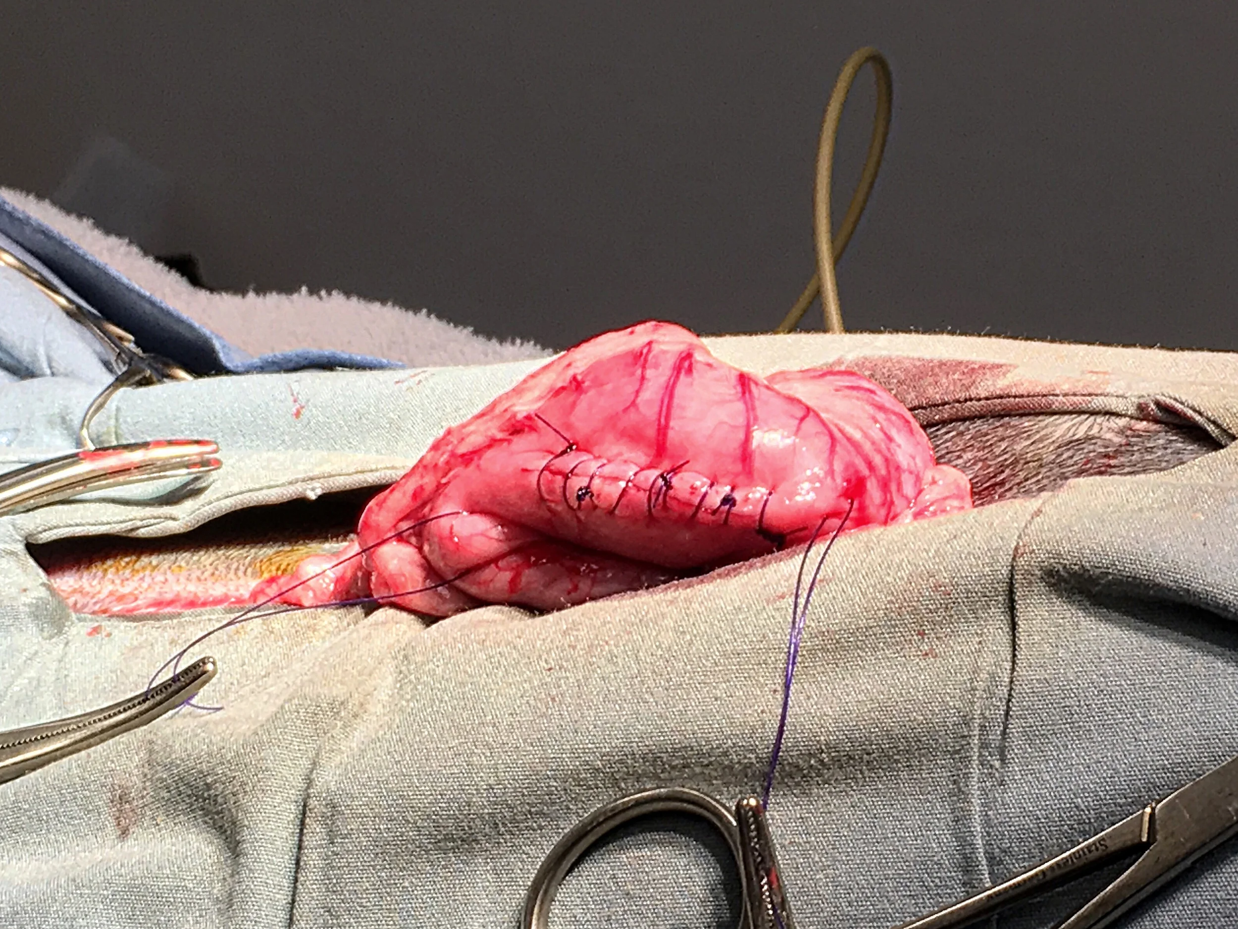 Jake's stomach incision closed. The suture material is broken down by the body over the next 9 weeks after the incision has healed.