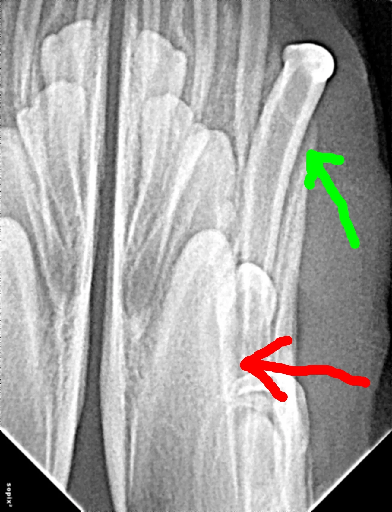 Xray.jpg