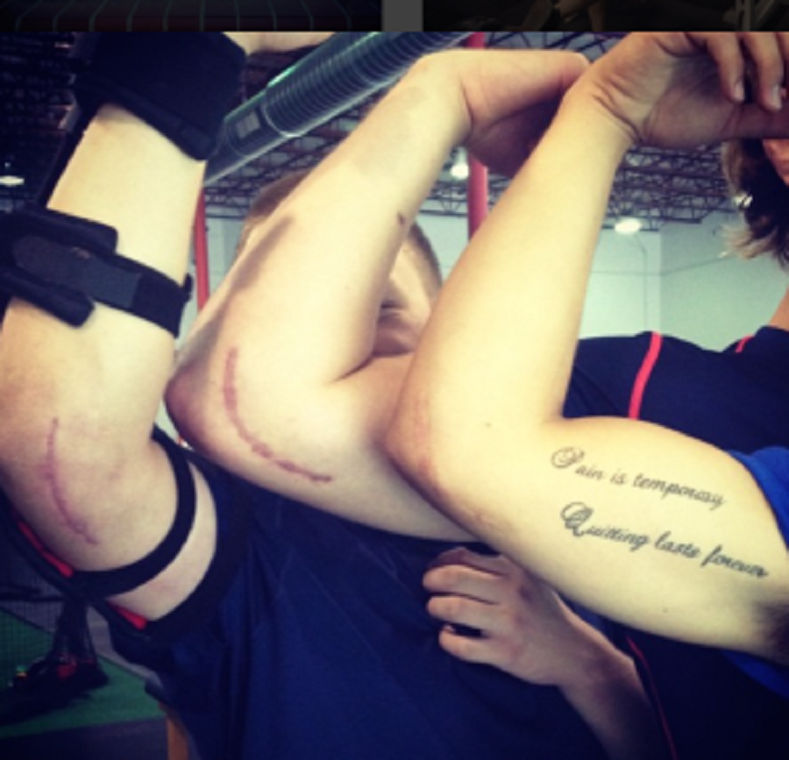 How to prevent injuries: with actions, not words