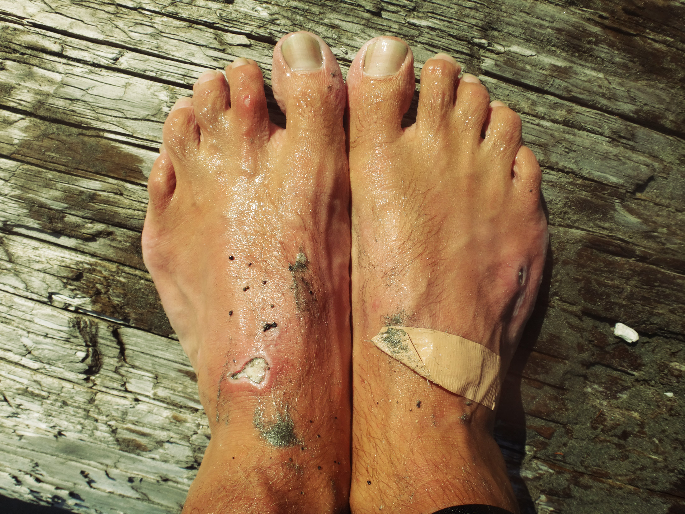 Sea sores and waterlogged feet. Sorry lads. 