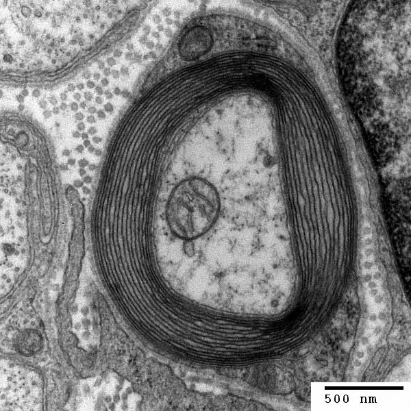 The Speed of Neurons: a Study in Contrasts