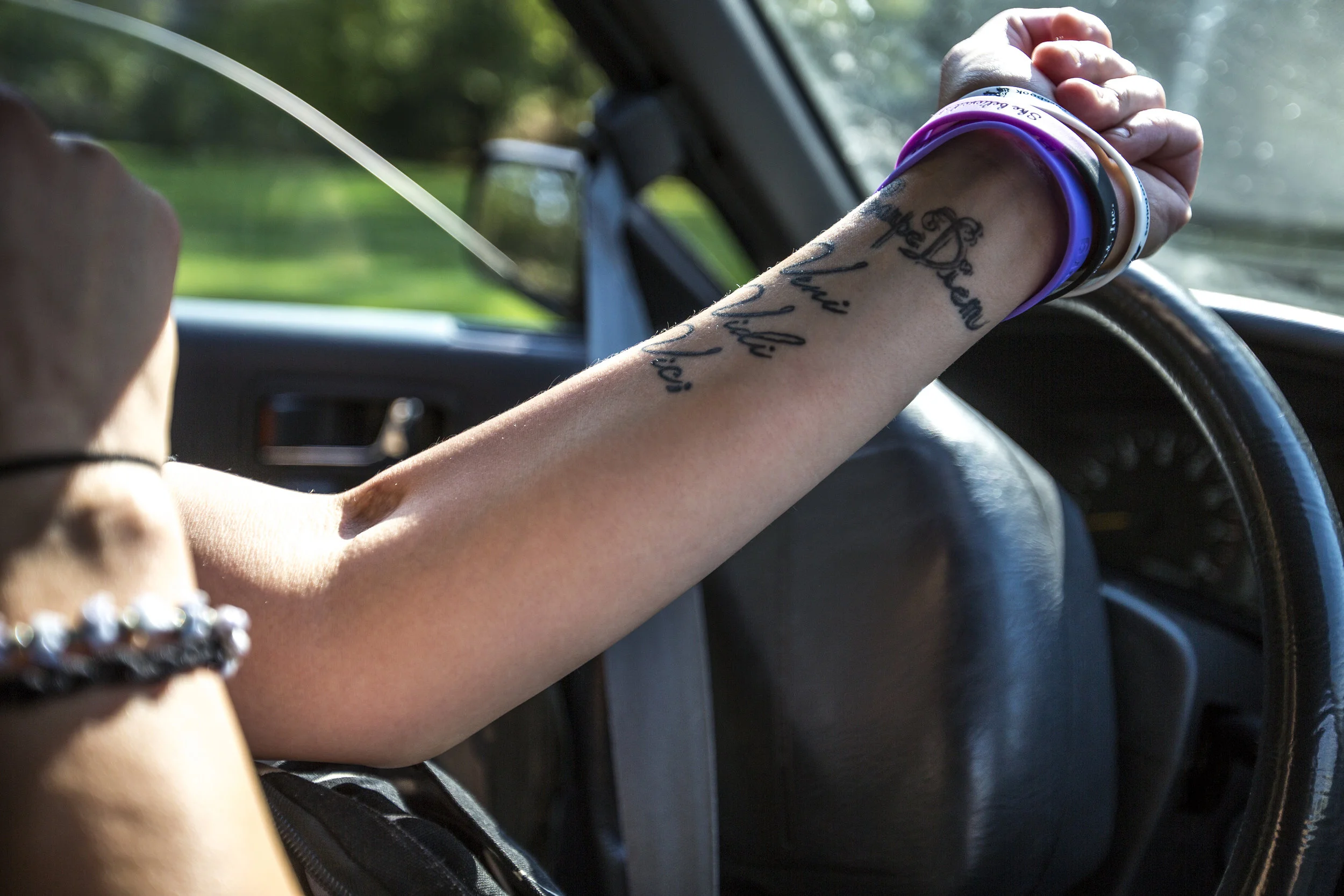 Palmieri shows her arm that still shows marks from heroin use. She has been clean since November 2016.
