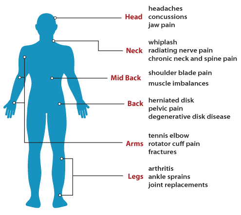 image from canadian academy of manipulative physiotherapy ( www.manippt.org)