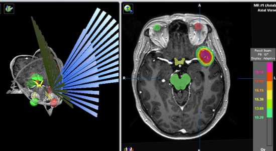 Metas cerebrales2.png