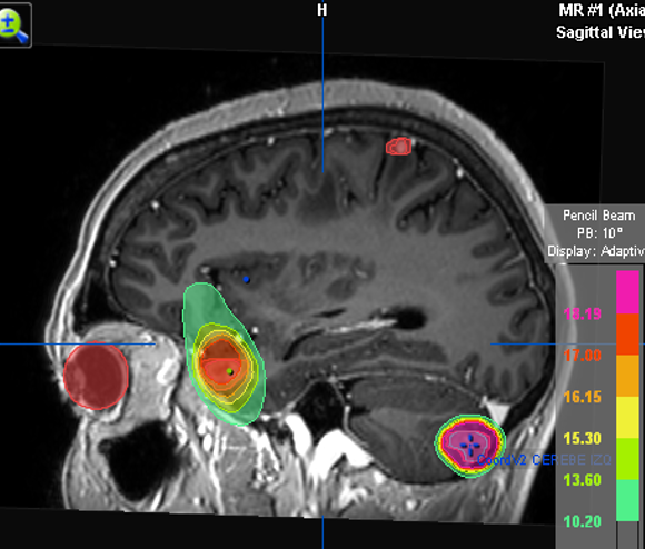 Metas cerebrales.png