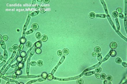 There's a Fungus Among Us: A Beginner's Guide to Antifungals — tl;dr ...