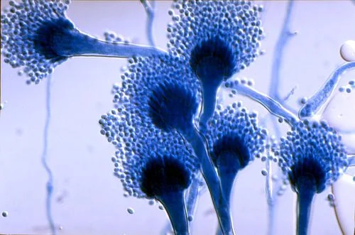 Aspergillus. All of those filament-looking things are hyphae ( Image )