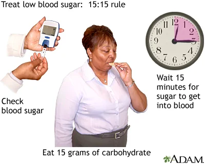 Hypoglycemia Rule of 15. (Image)