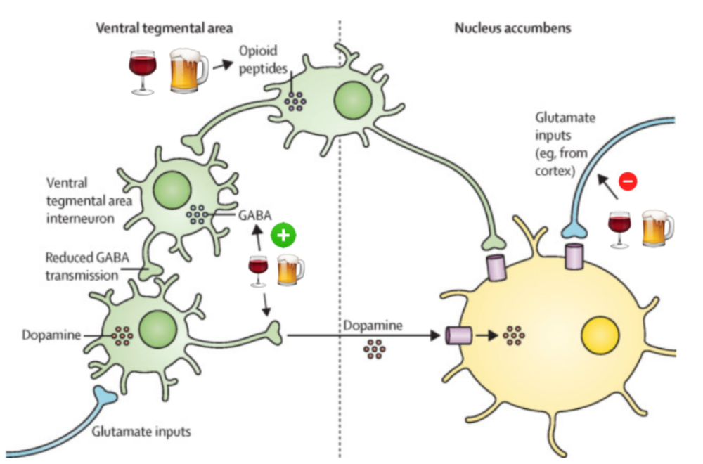 Alcohol neuroadaptation and reward: a visual representation. The image above demonstrates the complex physiology of neurons and neurotransmitters in the ventral tegmental area and nucleus accumbens and the acute effects of alcohol on the reward pathway. Alcohol (as shown by beer/wine) enhances the effects of GABA and opioid receptors while blunting the effects NMDA receptors. (Image from Connor et al. The Lancet . 2016. )