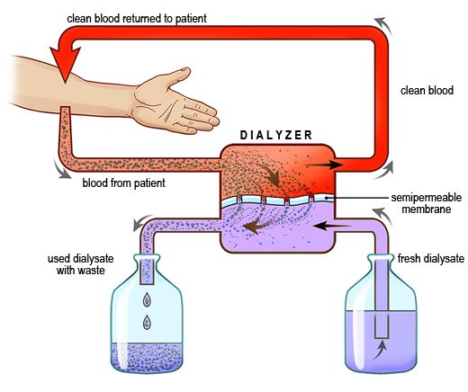 A schematic of the HD process (only diffusion is illustrated here). (Image)