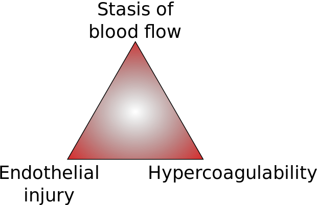 Virchow’s Triad ( Image )
