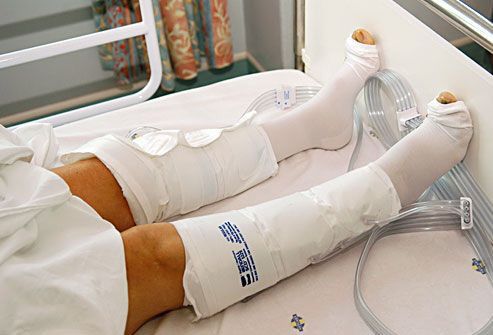 after surgery leg compression after surgery leg compression