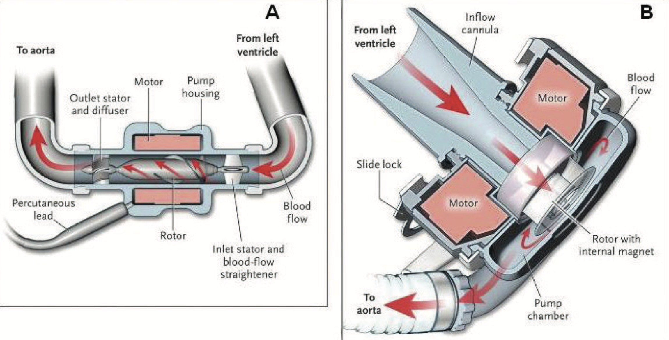 Panel A is an axial flow continuous LVAD. Panel B is a centrifugal-flow continuous LVAD. ( Image )