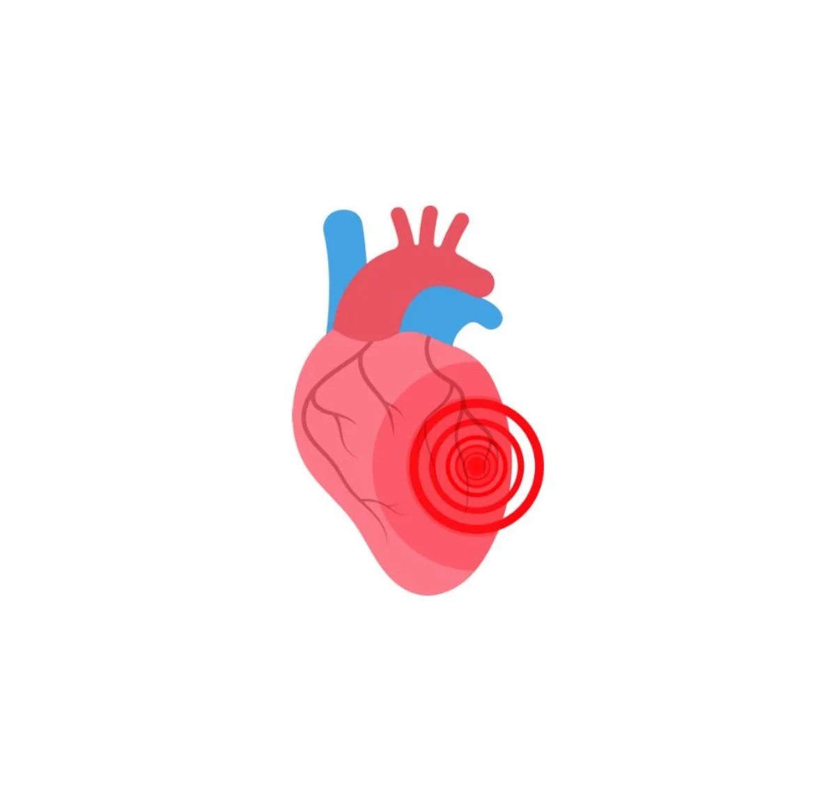 The Pharmacist's Heart to Heart on Endocarditis