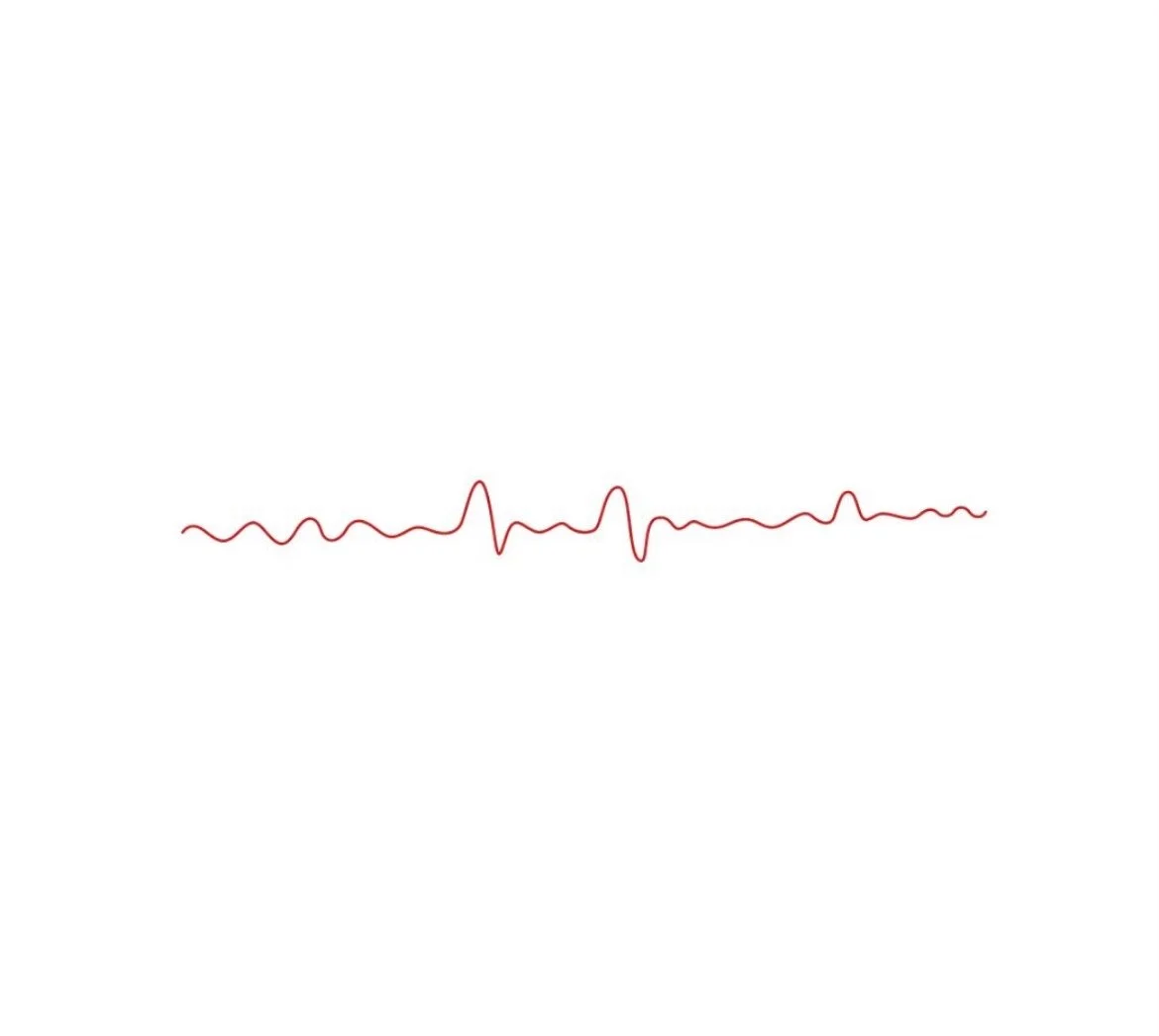 The tl;dr Case of the Month: Atrial Fibrillation