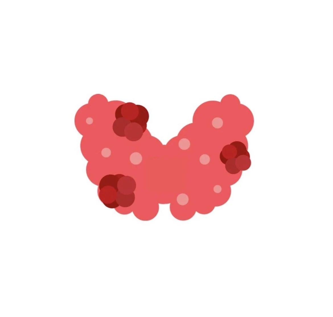 The tl;dr Case of the Month: Thyroid Disorders