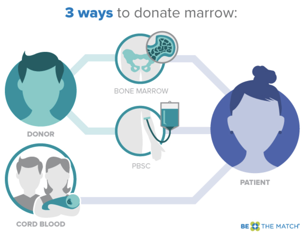 Сколько платят за донорство костного. Донорство крови и костного мозга. Трансплантация костного мозга. Костныйсозг донорство. Костный мозг пересадка доноры.