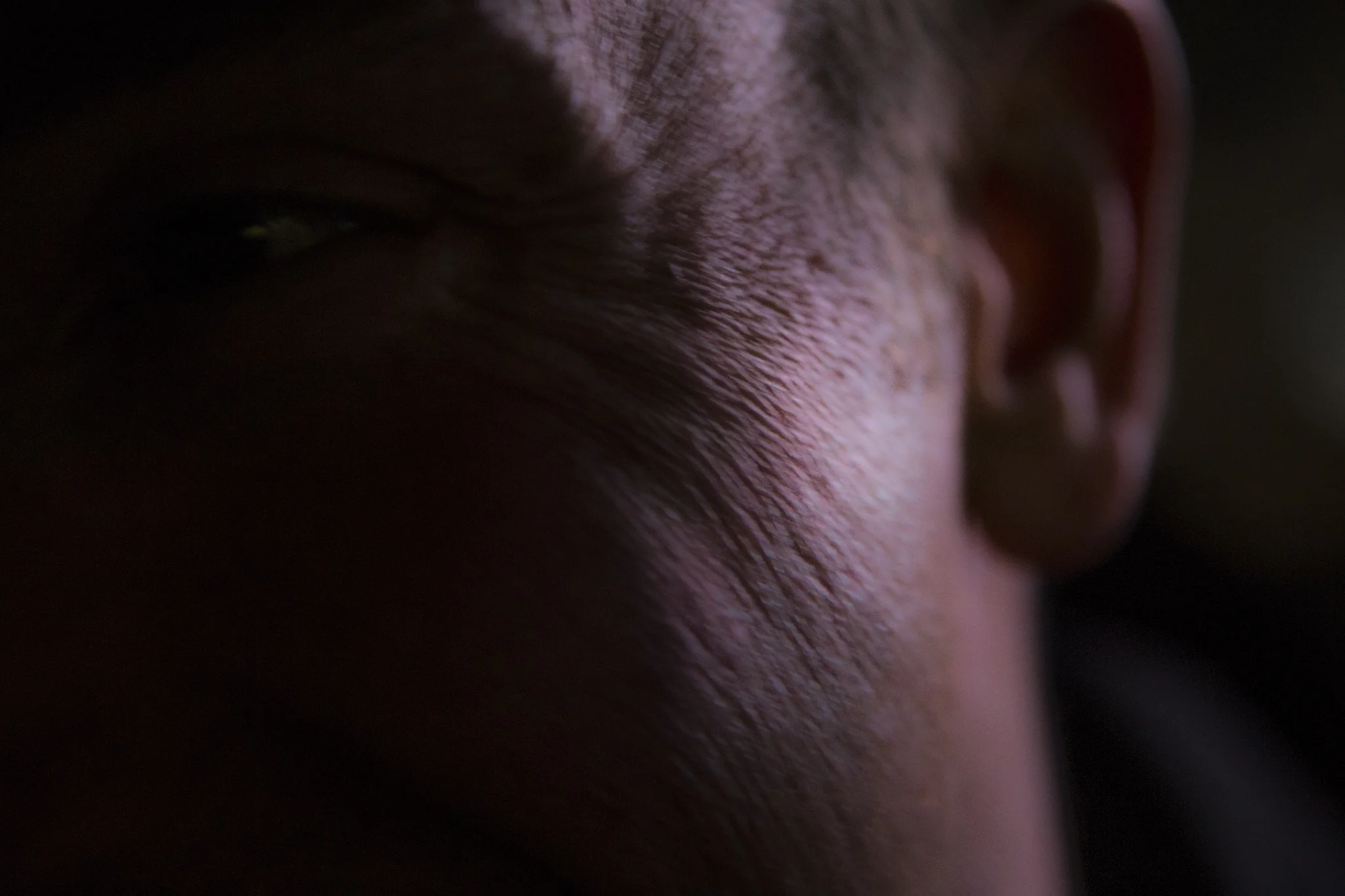 "Skin"