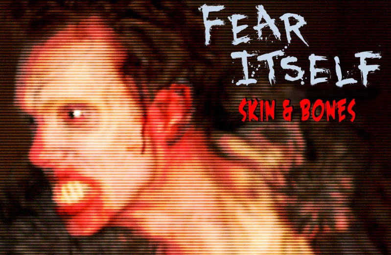 209. Skin and Bones episode artwork